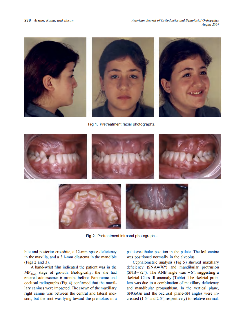 2004_126_2_237_244_Arslan.pdf 第2页