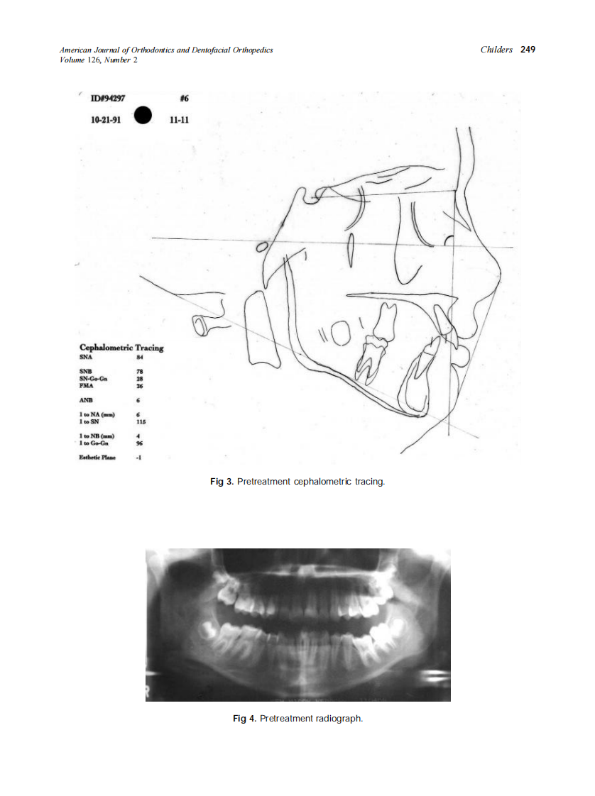 2004_126_2_245_253_Childers.pdf 第5页