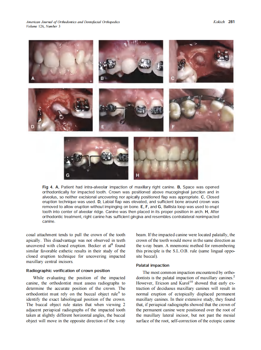 2004_126_3_278_283_Kokich.pdf 第4页