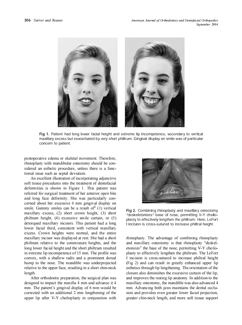 2004_126_3_305_307_Sarver.pdf 第2页