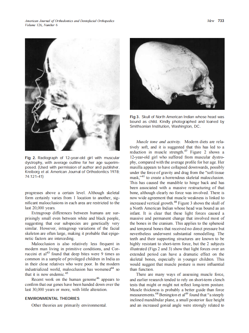 2004_126_6_729_738_Mew.pdf 第5页