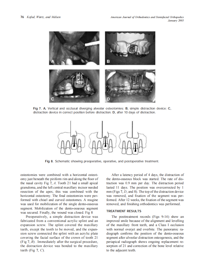 2005_127_1_72_80_Kofod.pdf 第5页