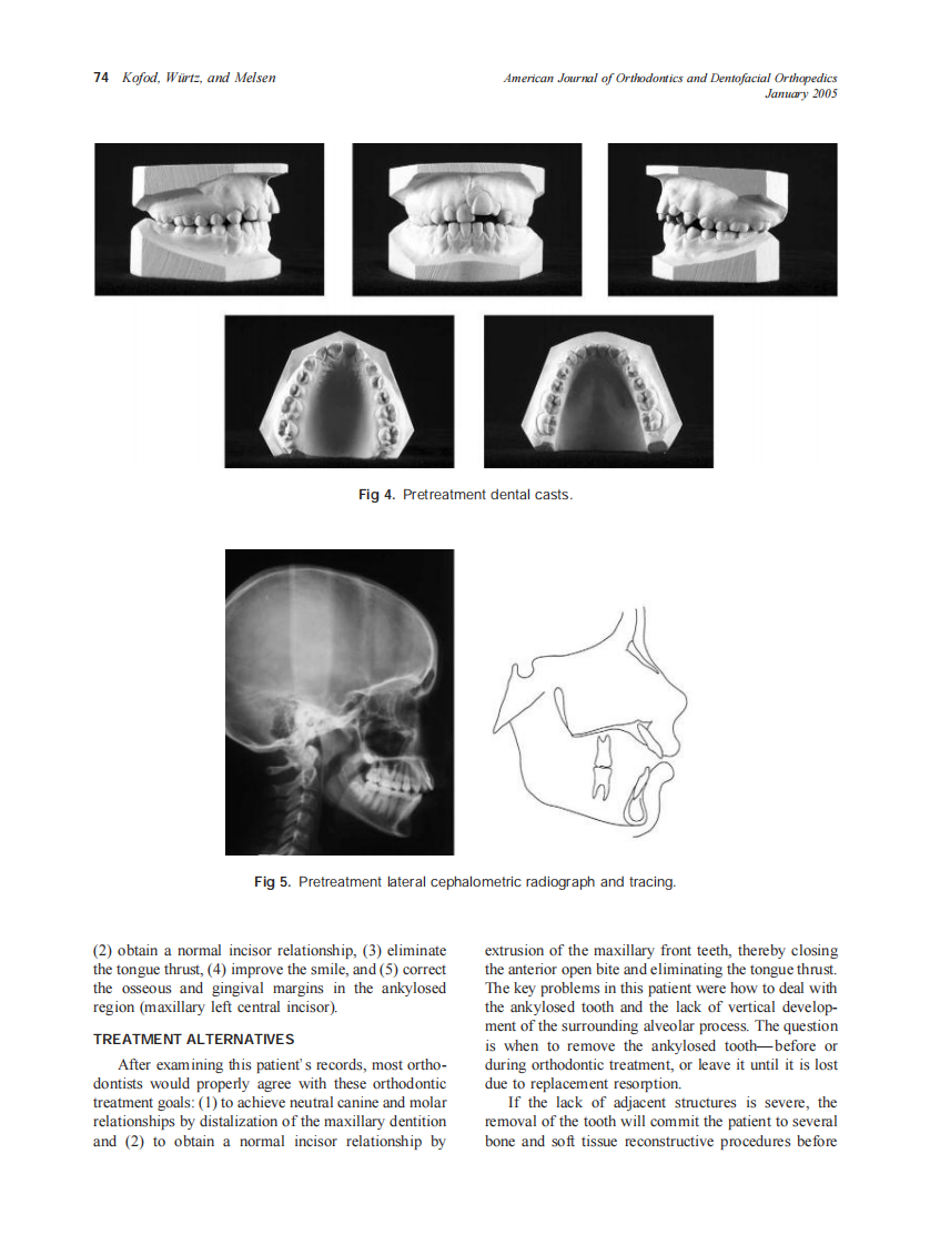 2005_127_1_72_80_Kofod.pdf 第3页