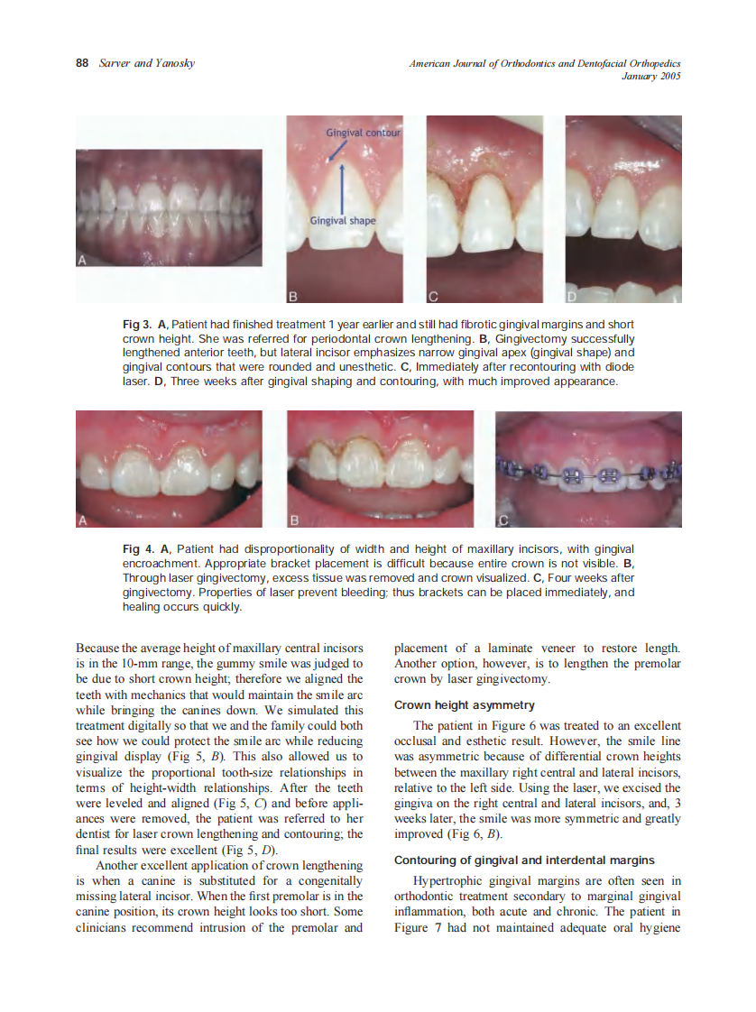 2005_127_1_85_90_Sarver.pdf 第4页