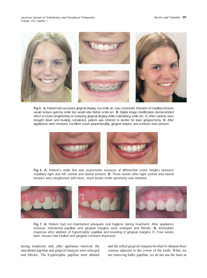 2005_127_1_85_90_Sarver.pdf 第5页