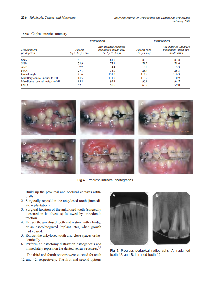 2005_127_2_233_241_Takahashi.pdf 第4页