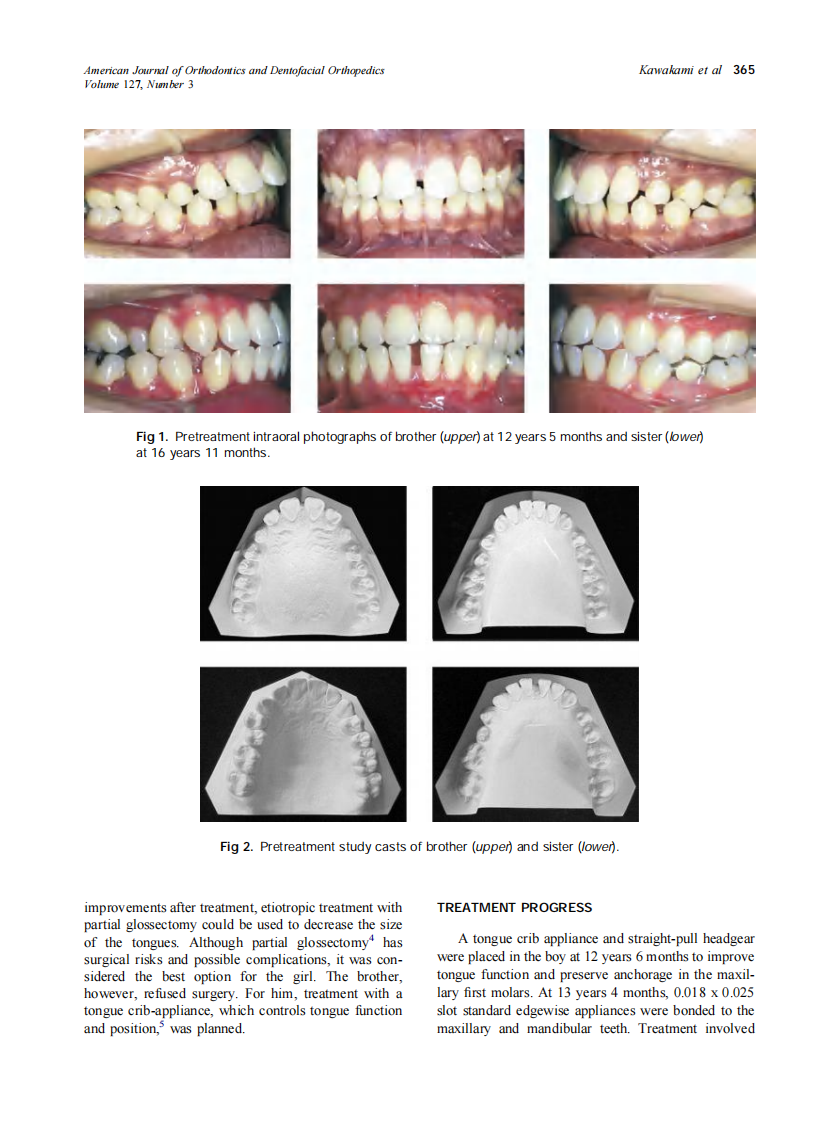2005_127_3_364_373_Kawakami.pdf 第2页
