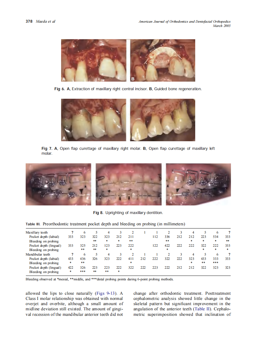 2005_127_3_374_384_Maeda.pdf 第5页