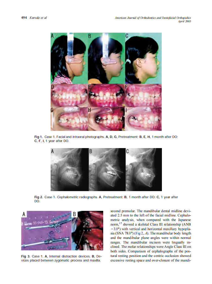 2005_127_4_493_498_Kuroda.pdf 第2页