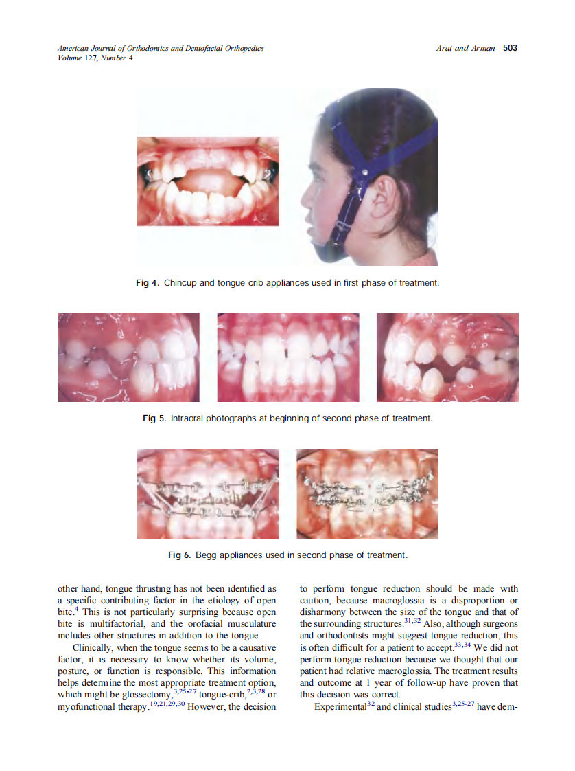 2005_127_4_499_509_Arat.pdf 第5页