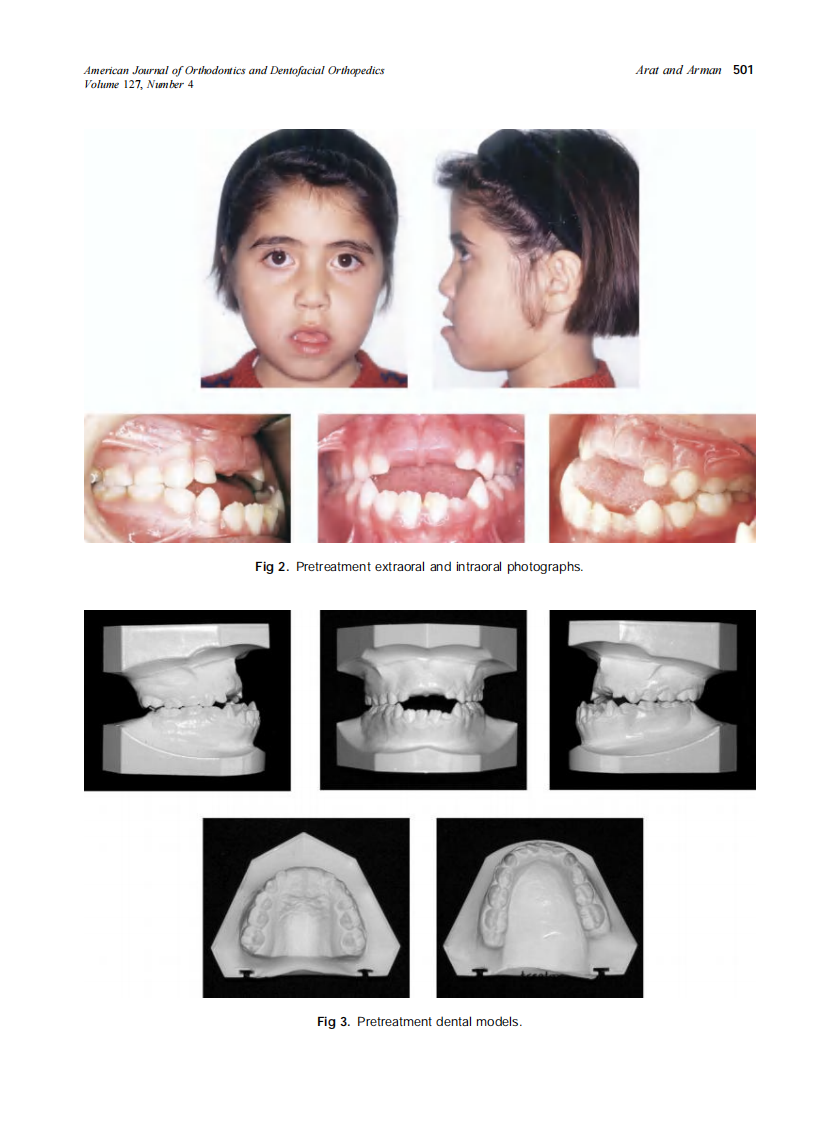 2005_127_4_499_509_Arat.pdf 第3页