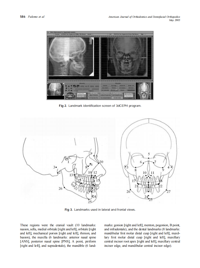 2005_127_5_584_591_Palomo.pdf 第3页
