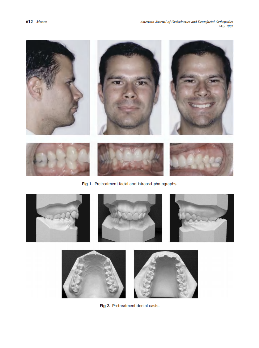 2005_127_5_611_617_Munoz.pdf 第2页