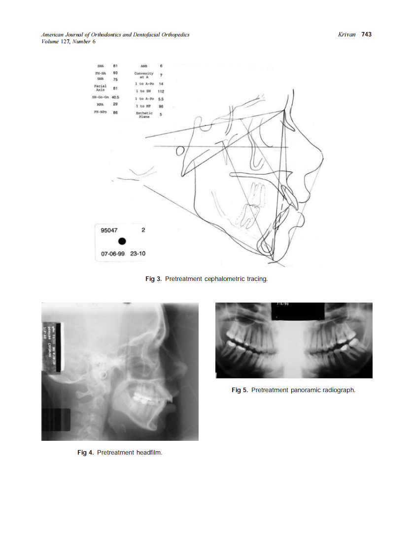 2005_127_6_739_748_Krivan.pdf 第5页