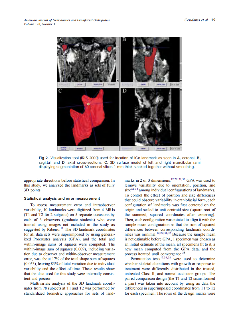 2005_128_1_16_26_Cevidanes.pdf 第4页