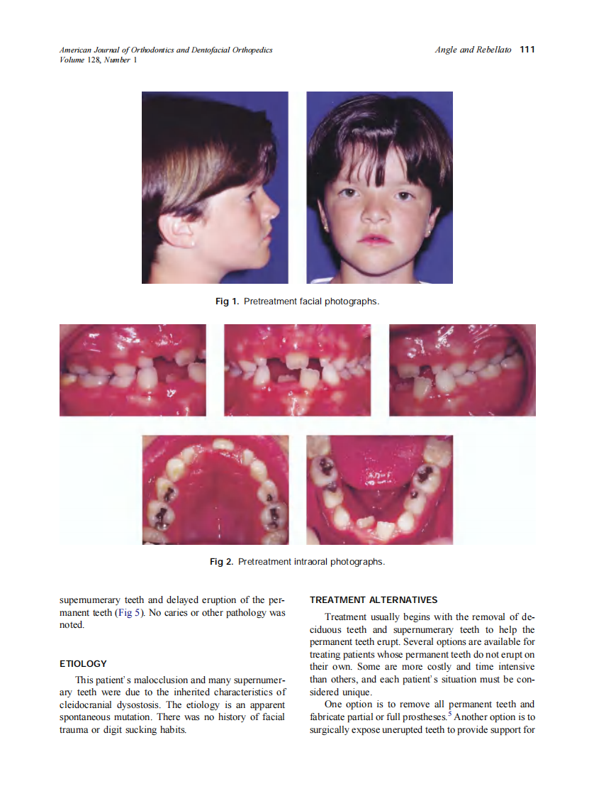 2005_128_1_110_117_Angle.pdf 第2页