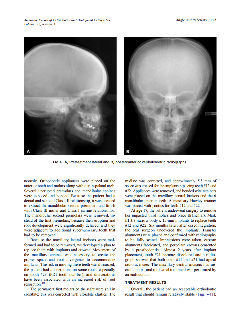 2005_128_1_110_117_Angle.pdf 第4页