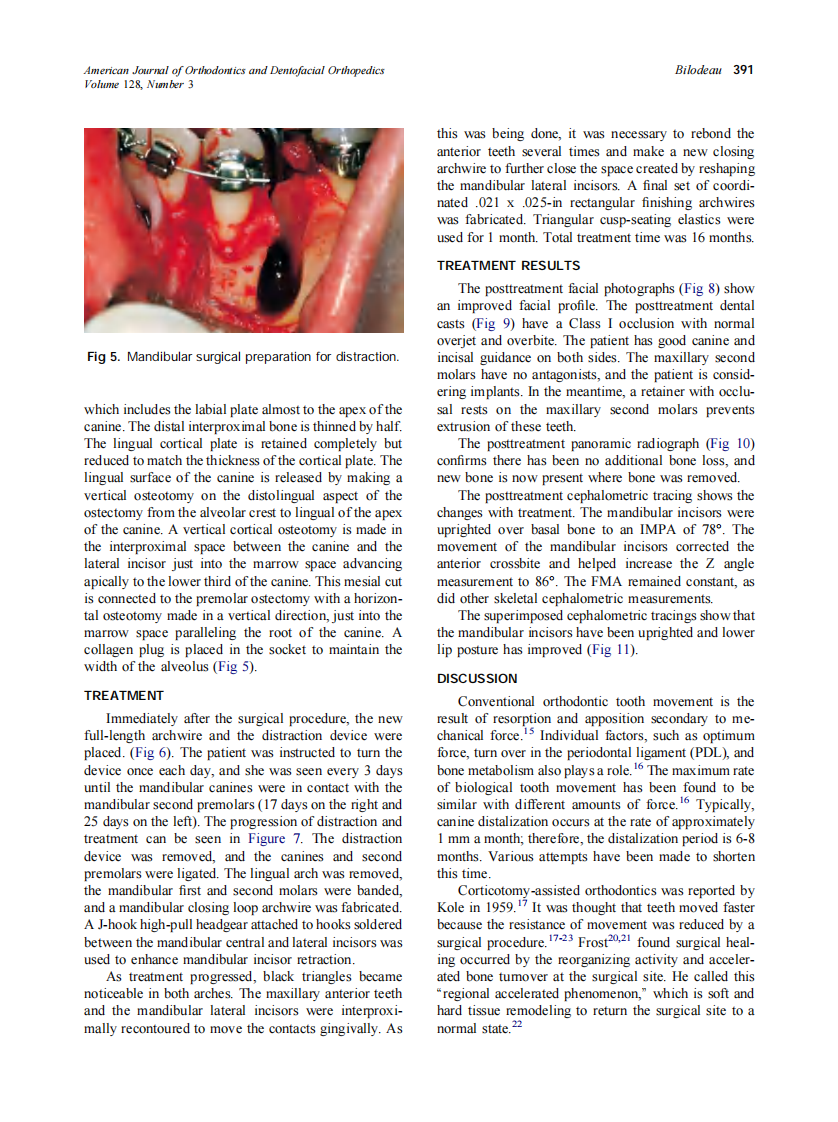 2005_128_3_388_396_Bilodeau.pdf 第4页