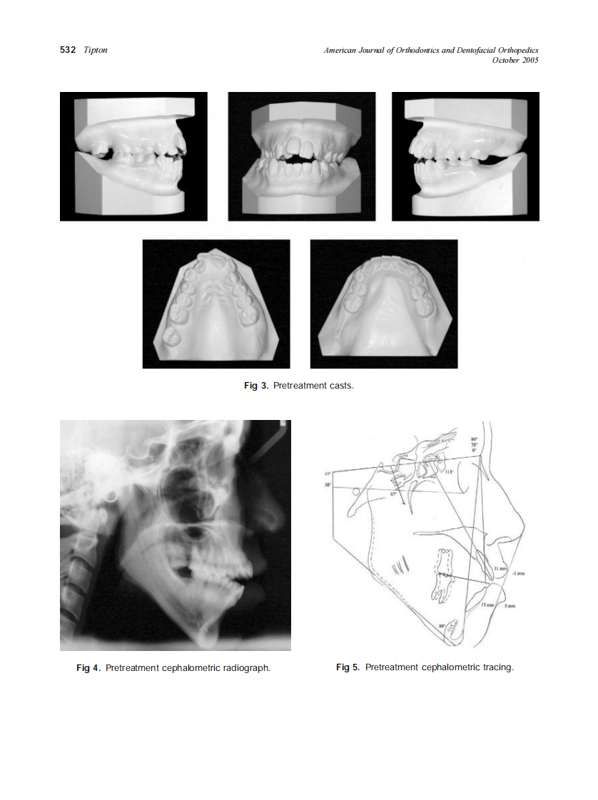 2005_128_4_528_534_Tipton.pdf 第5页