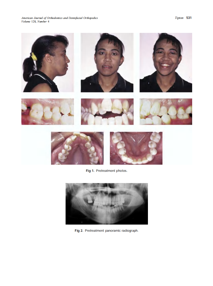 2005_128_4_528_534_Tipton.pdf 第4页