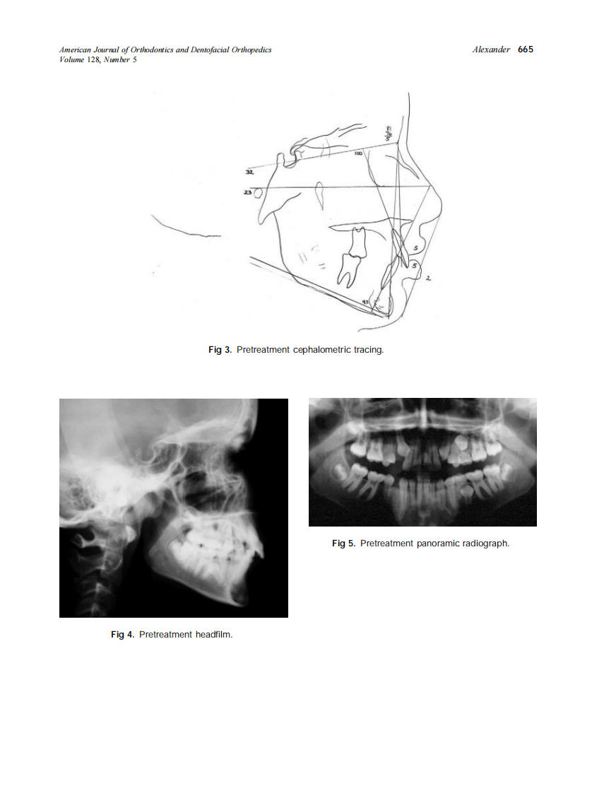 2005_128_5_661_668_Alexander.pdf 第5页