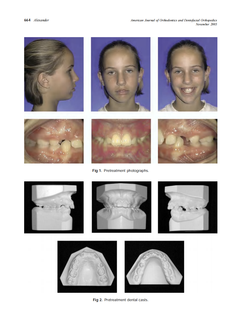 2005_128_5_661_668_Alexander.pdf 第4页