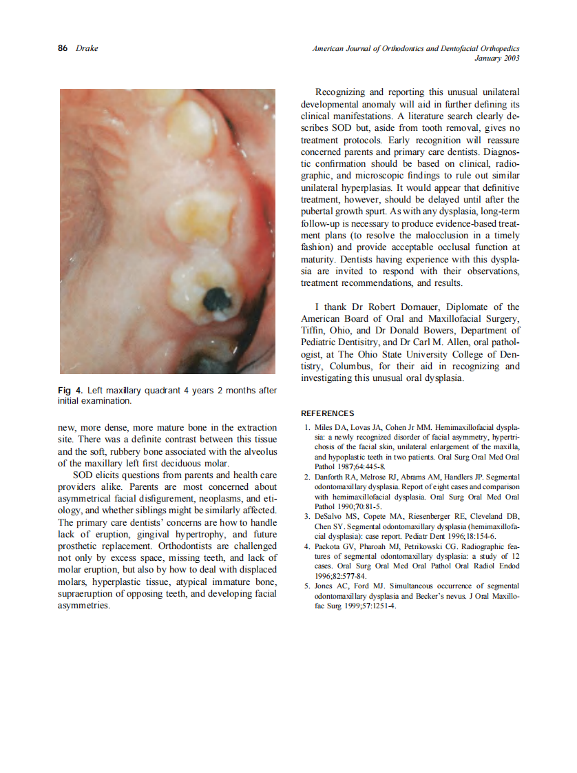 2003_123_1_84_86_Drake.pdf 第3页