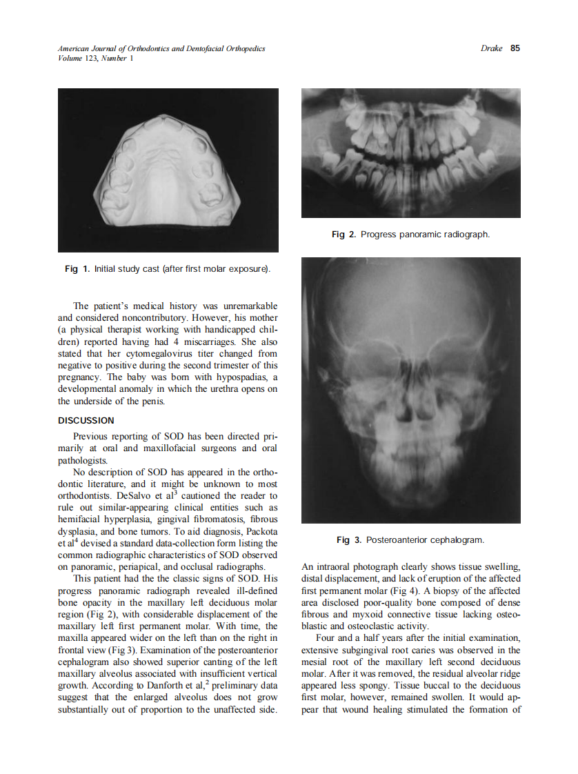 2003_123_1_84_86_Drake.pdf 第2页