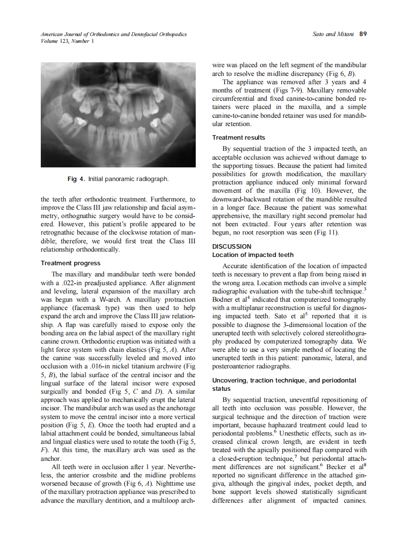 2003_123_1_87_92_Sato.pdf 第3页