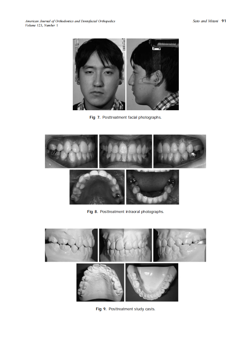 2003_123_1_87_92_Sato.pdf 第5页