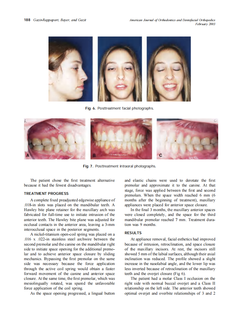 2003_123_2_185_191_Gazit-Rappaport.pdf 第4页