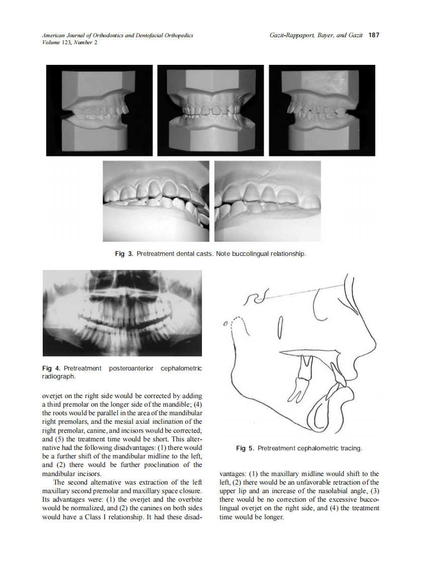 2003_123_2_185_191_Gazit-Rappaport.pdf 第3页