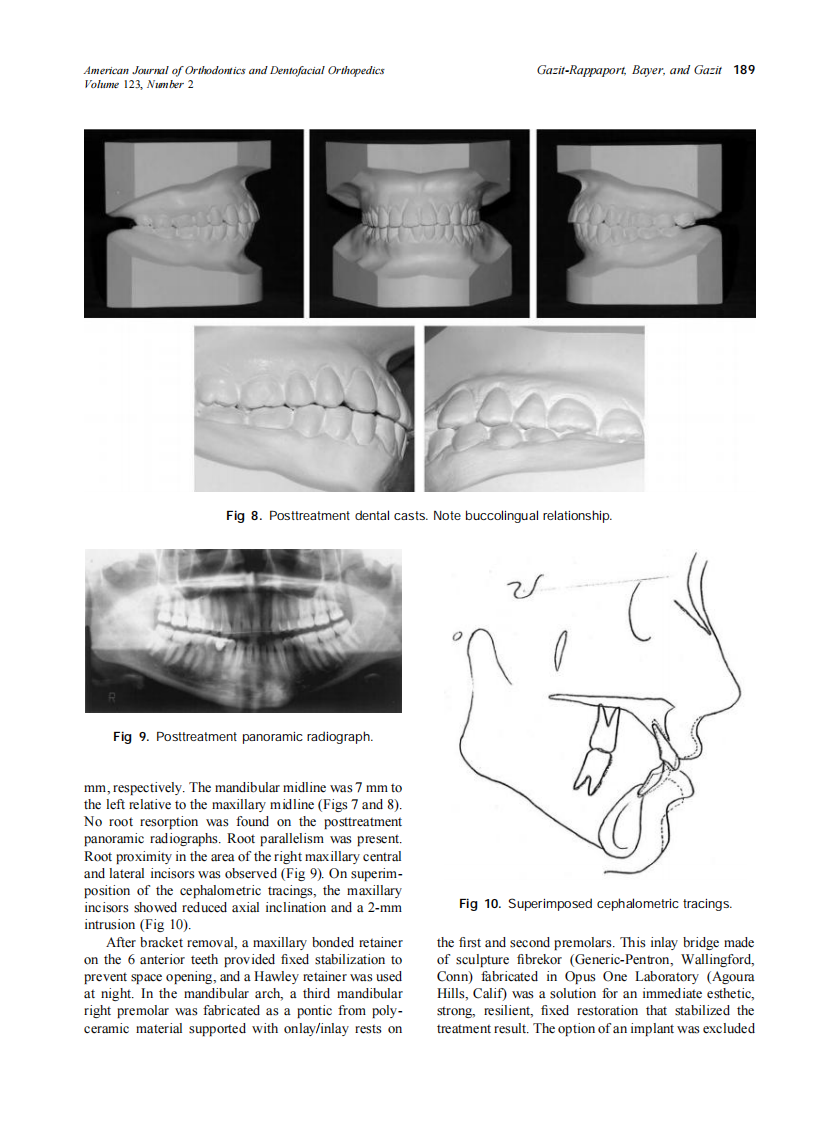 2003_123_2_185_191_Gazit-Rappaport.pdf 第5页