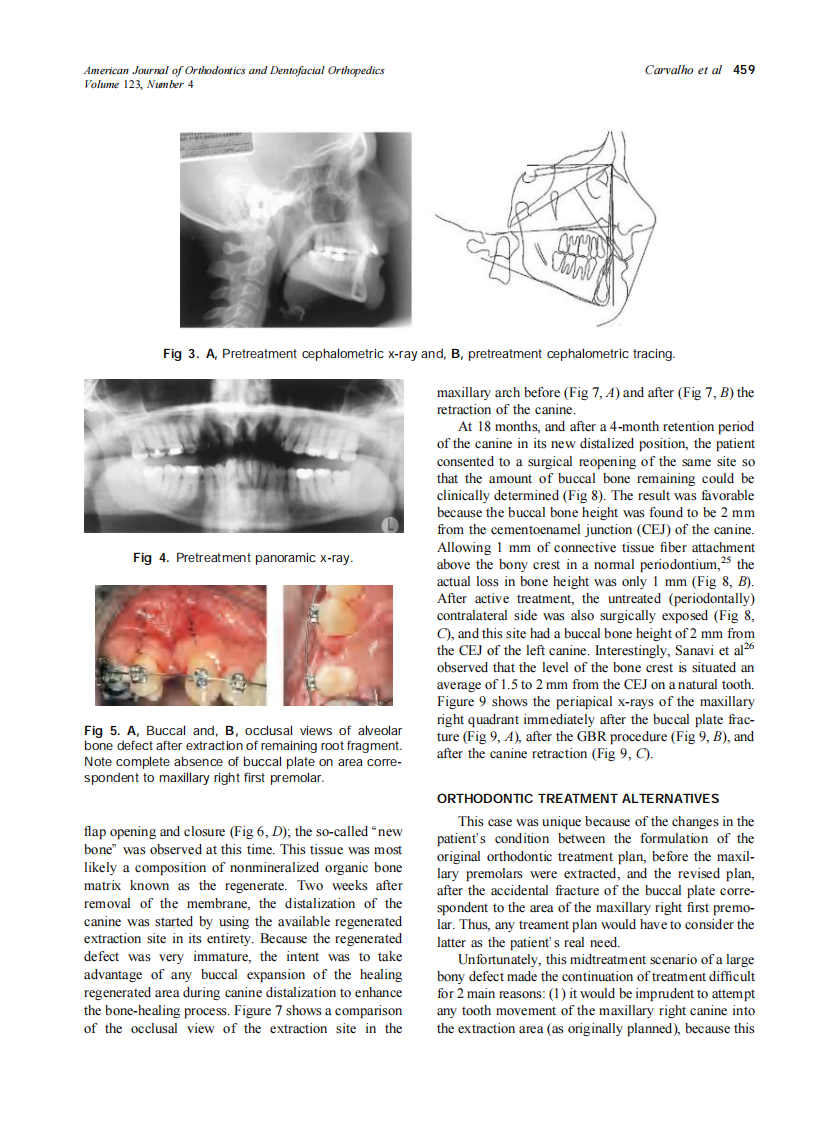 2003_123_4_455_467_Carvalho.pdf 第5页