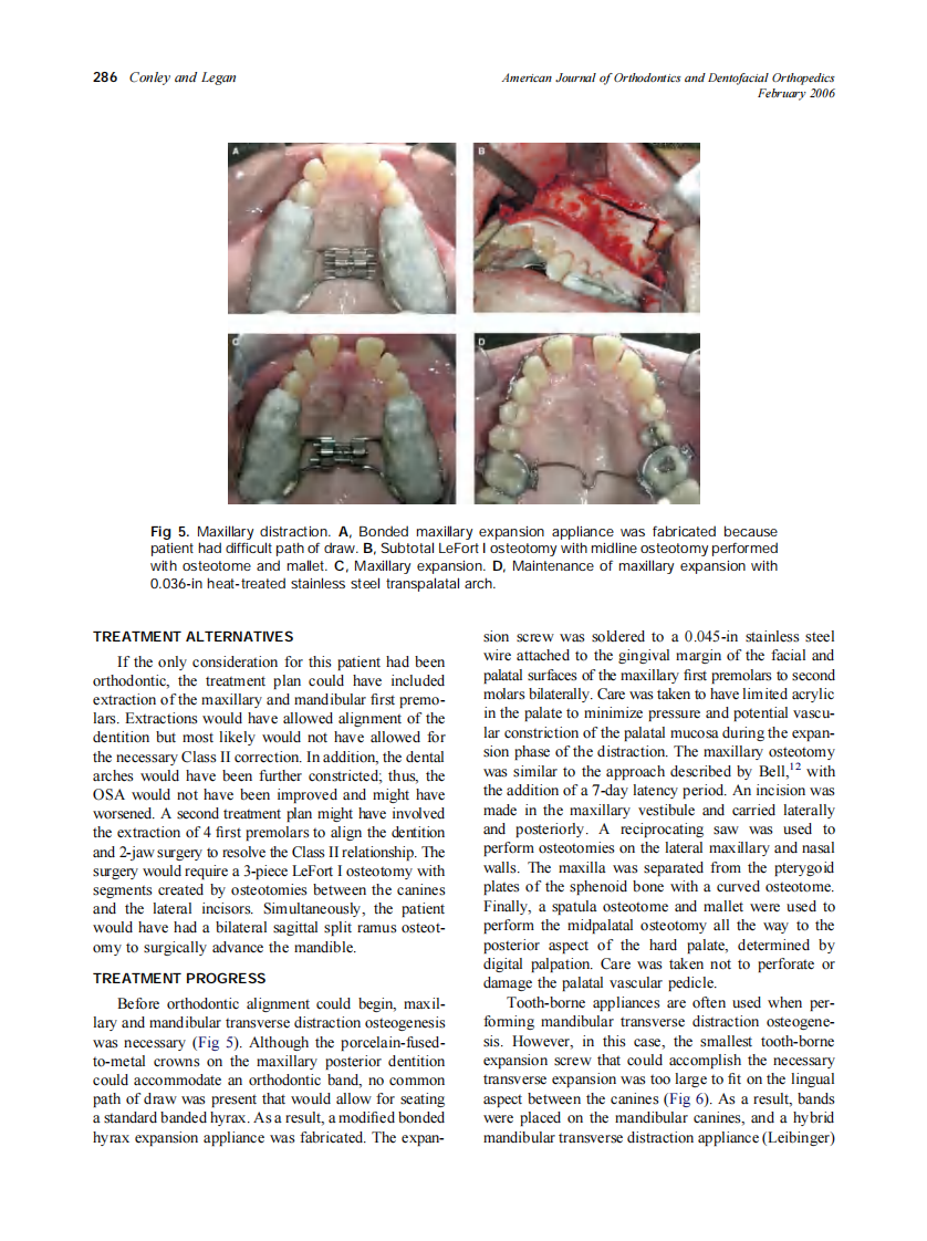 2006_129_2_283_292_Conley.pdf 第4页