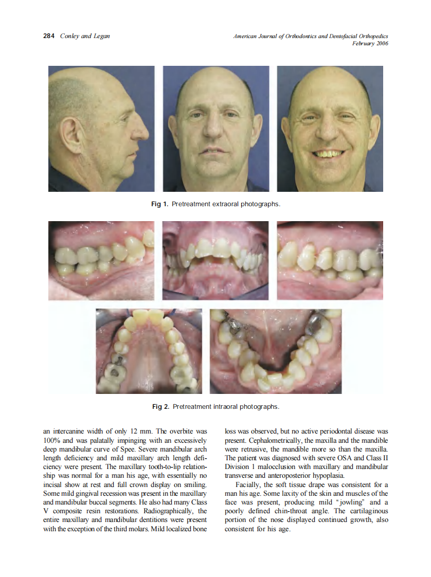 2006_129_2_283_292_Conley.pdf 第2页