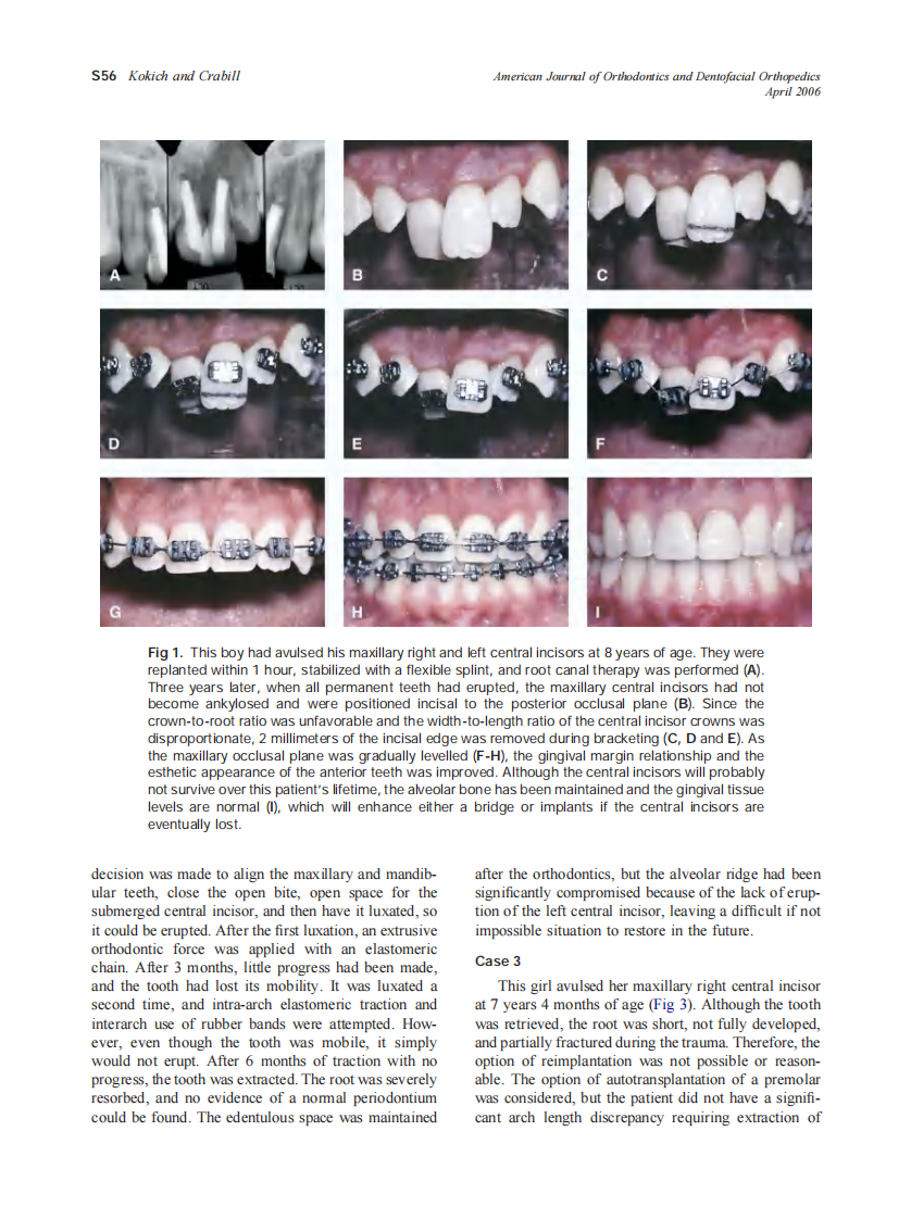 2006_129_4-Suppl-1_S55_S63_Kokich.pdf 第2页