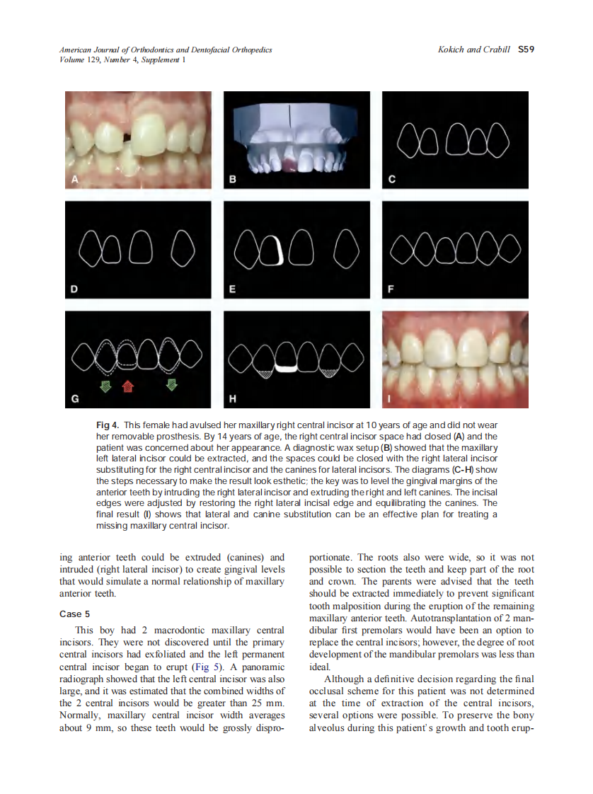 2006_129_4-Suppl-1_S55_S63_Kokich.pdf 第5页