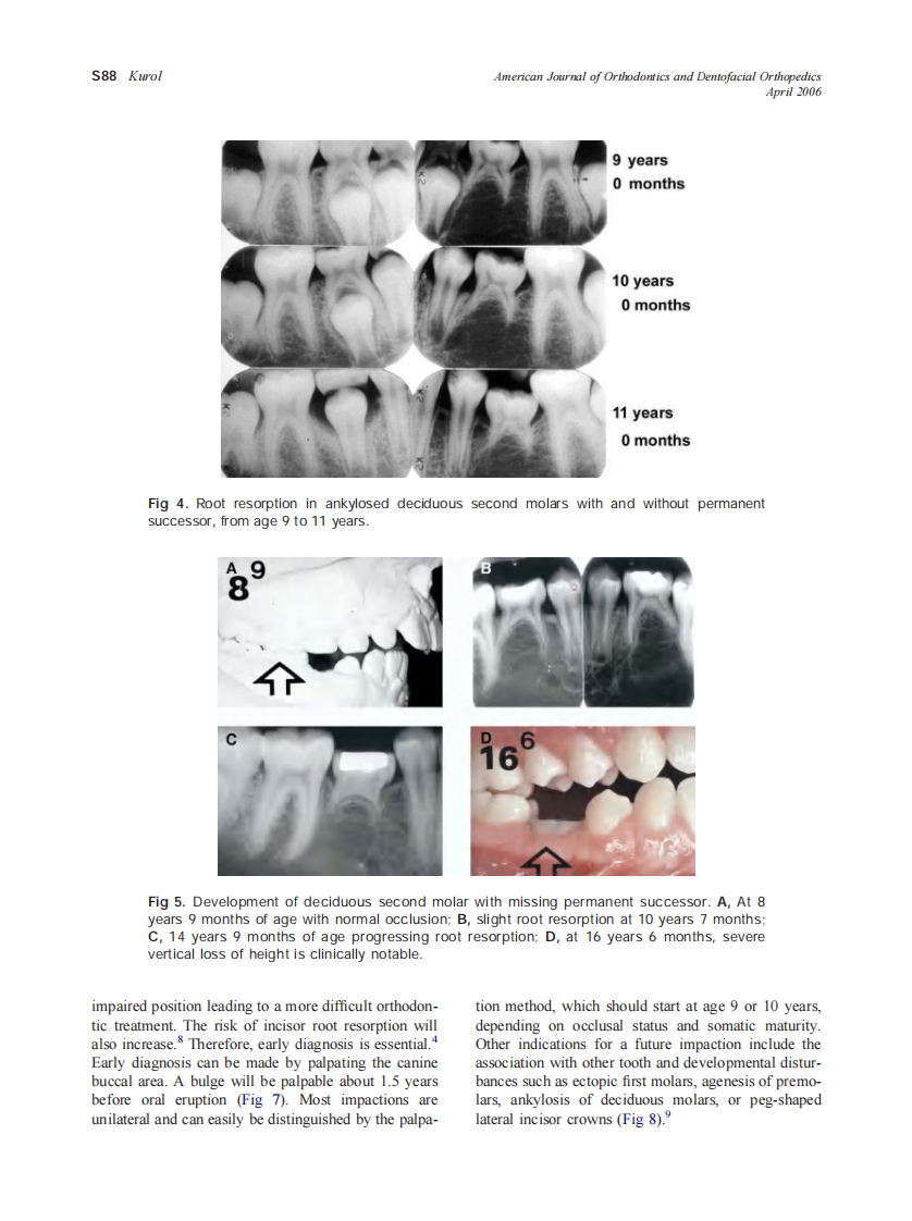 2006_129_4-Suppl-1_S86_S90_Kurol.pdf 第3页