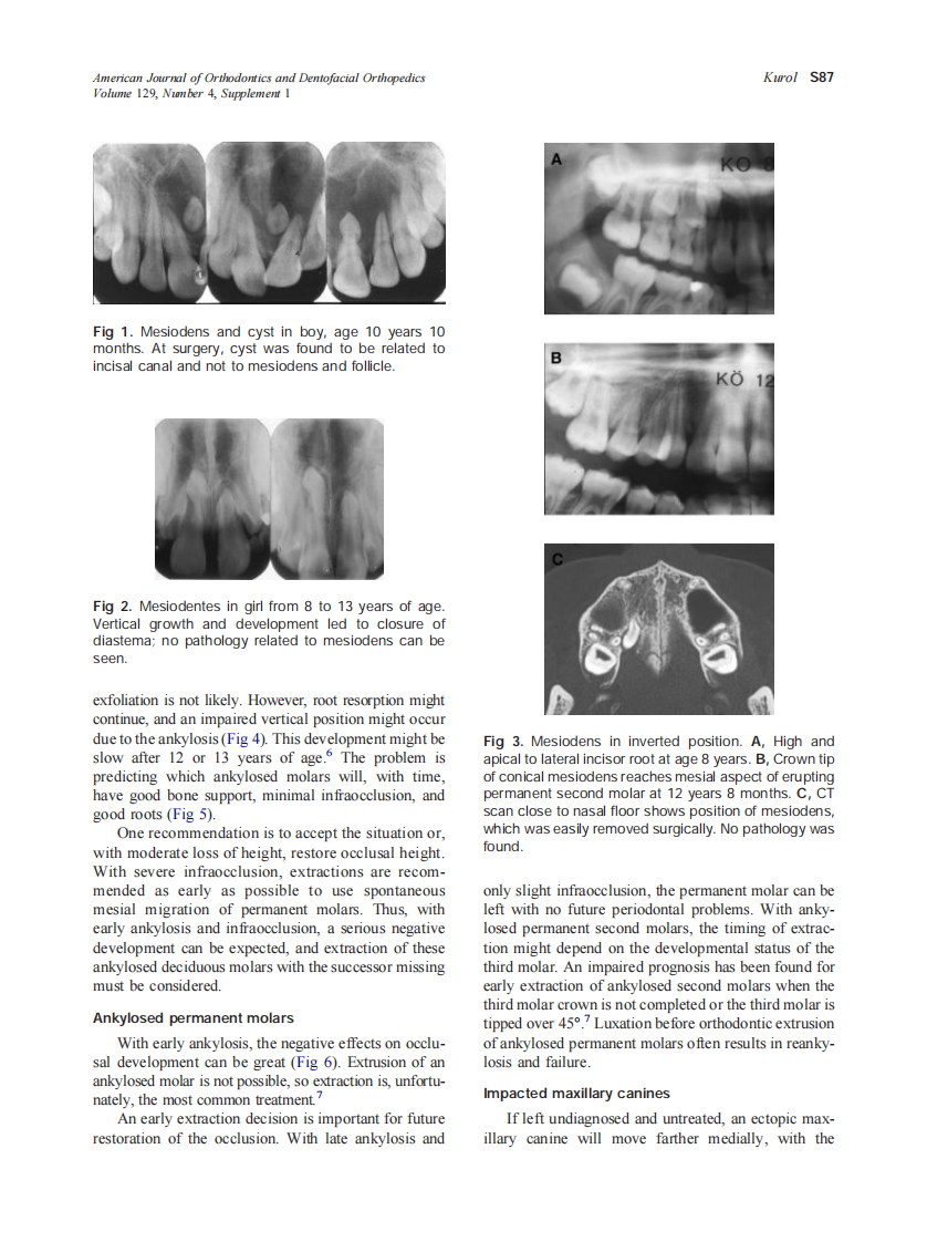 2006_129_4-Suppl-1_S86_S90_Kurol.pdf 第2页