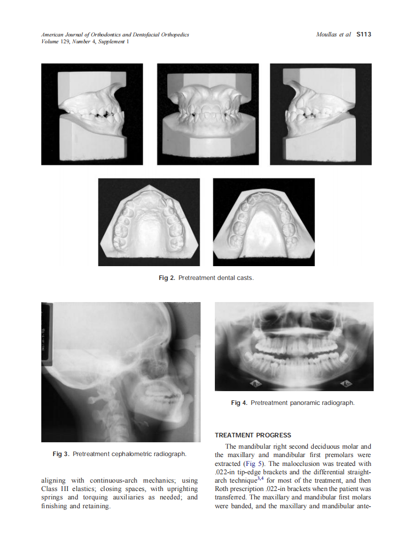 2006_129_4-Suppl-1_S111_S118_Moullas.pdf 第3页