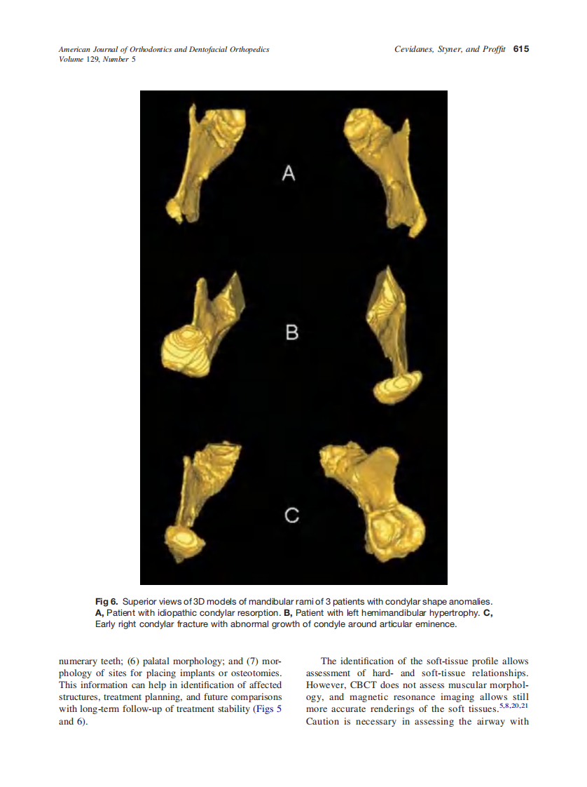2006_129_5_611_618_Cevidanes.pdf 第5页