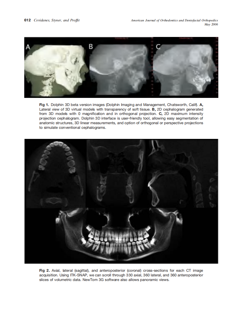 2006_129_5_611_618_Cevidanes.pdf 第2页