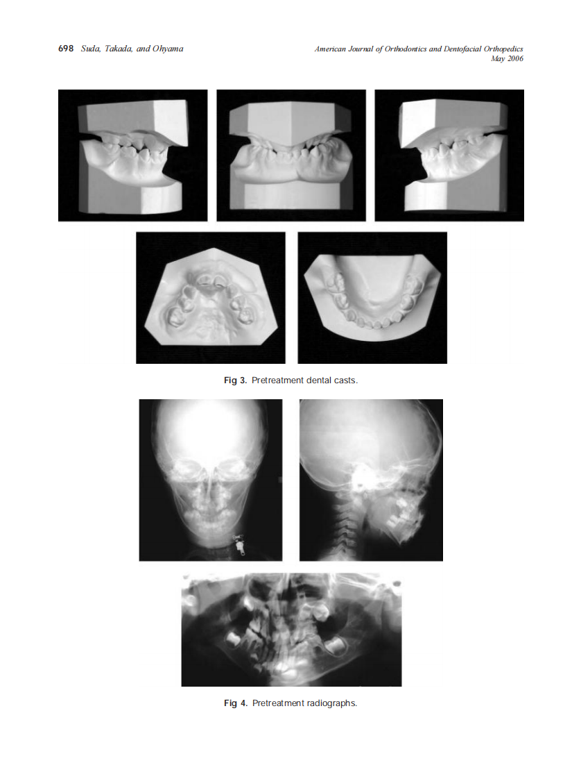 2006_129_5_696_705_Suda.pdf 第3页