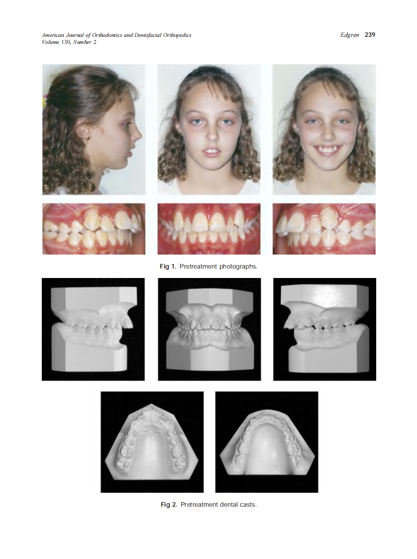 2006_130_2_236_243_Edgren.pdf 第4页