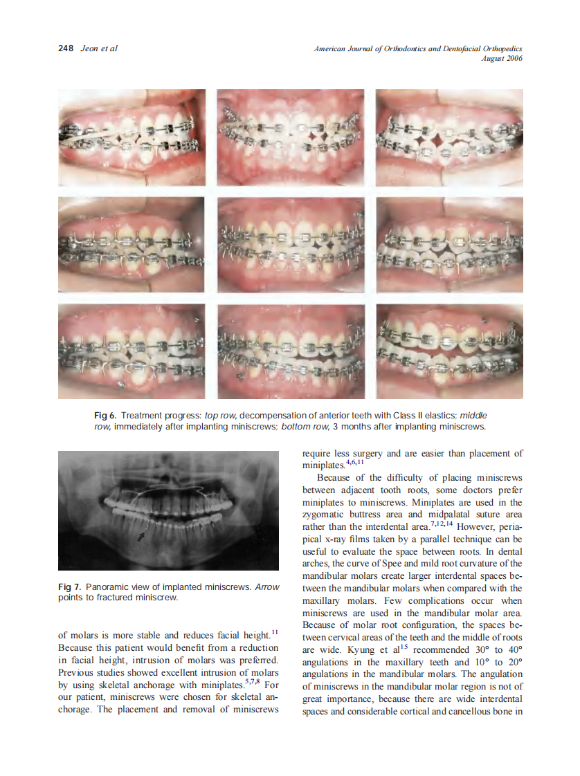 2006_130_2_244_252_Jeon.pdf 第5页