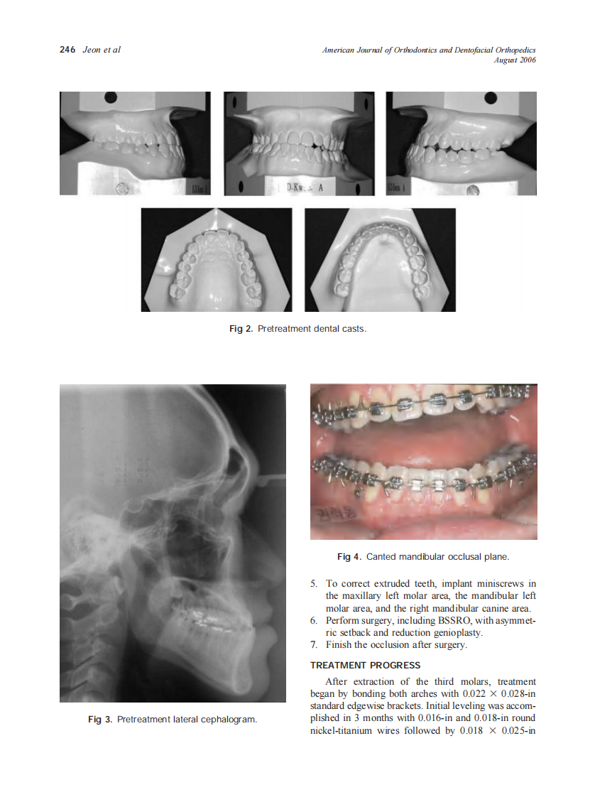 2006_130_2_244_252_Jeon.pdf 第3页