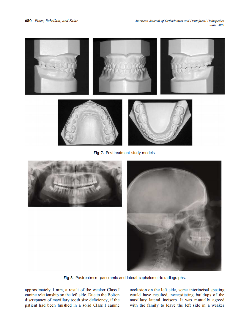 2003_123_6_676_682_Fines.pdf 第5页