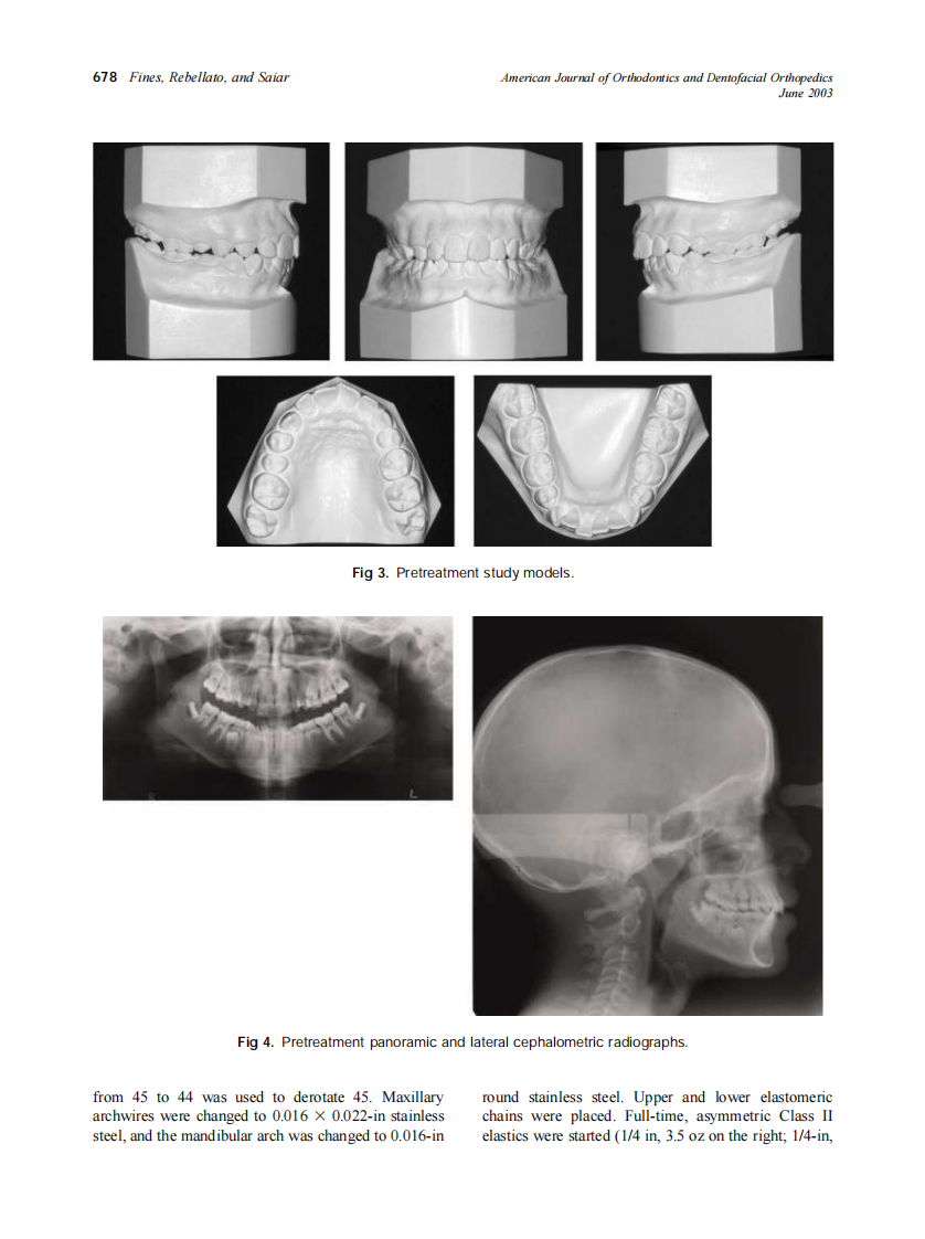 2003_123_6_676_682_Fines.pdf 第3页
