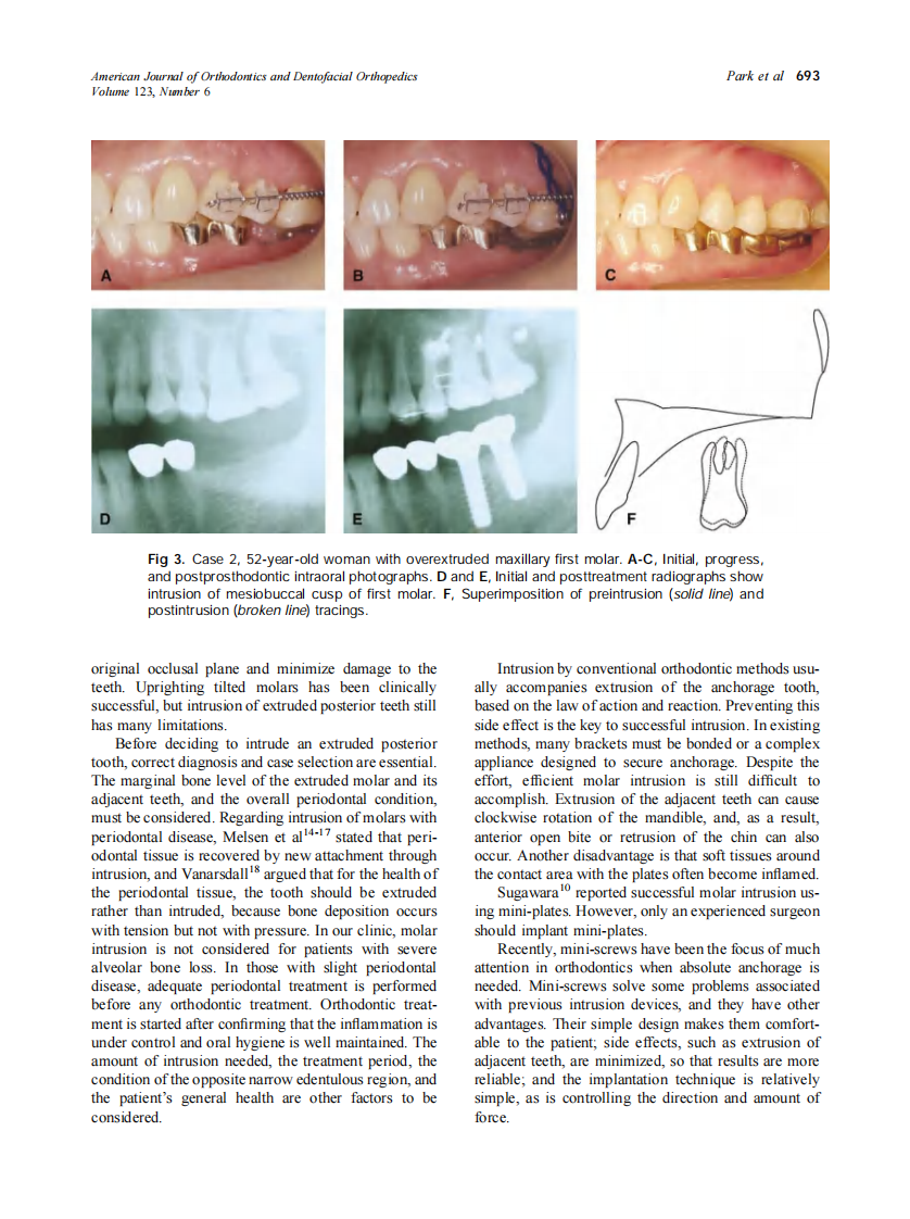 2003_123_6_690_694_Park.pdf 第4页